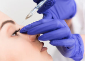 injection rhinoplasty